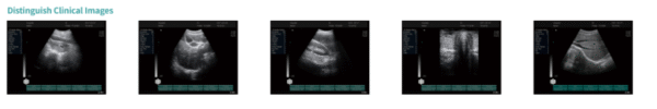 N20Full Digital Laptop Ultrasound Diagnostic System - 图片 4